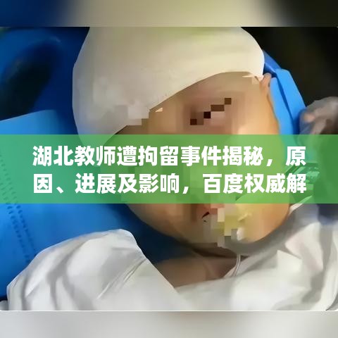 湖北教師遭拘留事件揭秘，原因、進(jìn)展及影響，百度權(quán)威解讀！