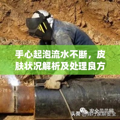 手心起泡流水不斷，皮膚狀況解析及處理良方