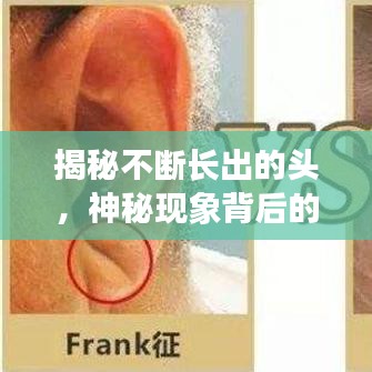 揭秘不斷長(zhǎng)出的頭，神秘現(xiàn)象背后的醫(yī)學(xué)探索之旅