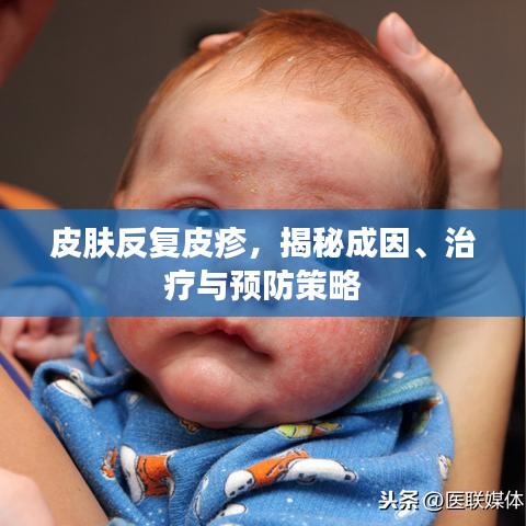 皮膚反復(fù)皮疹，揭秘成因、治療與預(yù)防策略