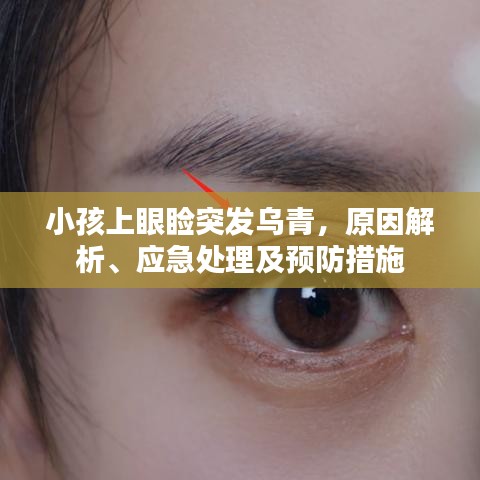 小孩上眼瞼突發(fā)烏青，原因解析、應(yīng)急處理及預(yù)防措施