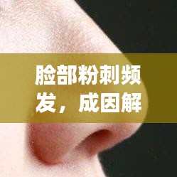 臉部粉刺頻發(fā)，成因解析與防治管理策略